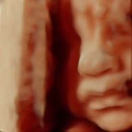 echo baby 3